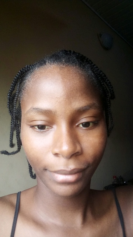 Urgent Radical Nephrectomy for my Fiancée