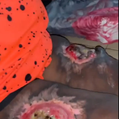 Medical Emergency to save Mrs. Gloria