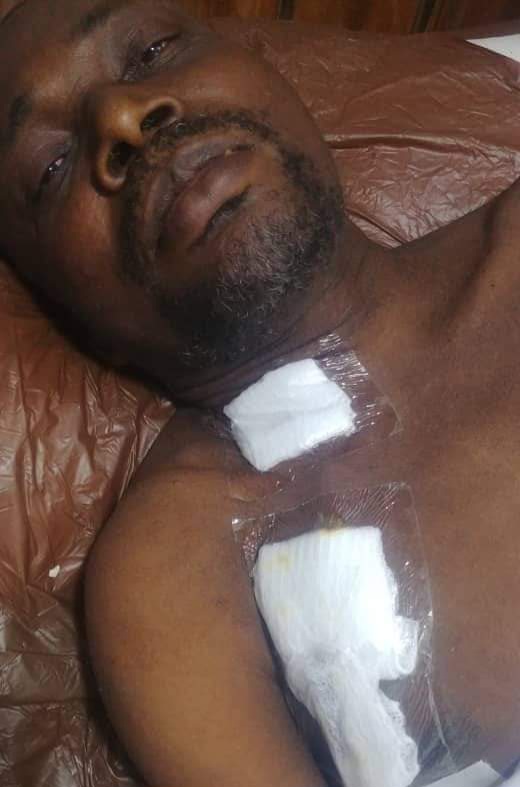 KIDNEY TRANSPLANT FOR EZE UBA