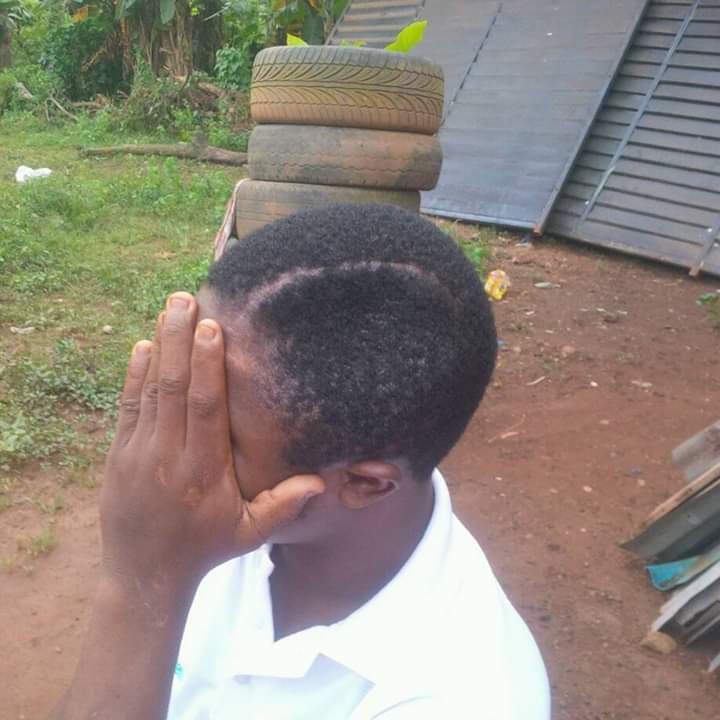 Surgery for an artificial skull