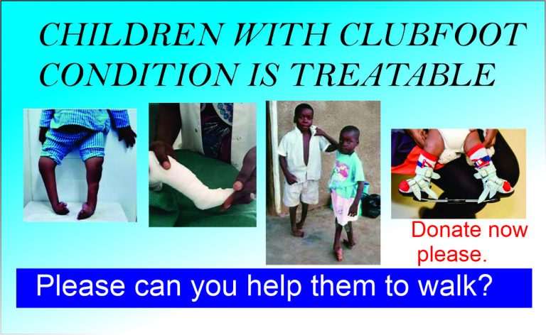 Help Children Walk Tall:  Free Clubfoot Treatment 