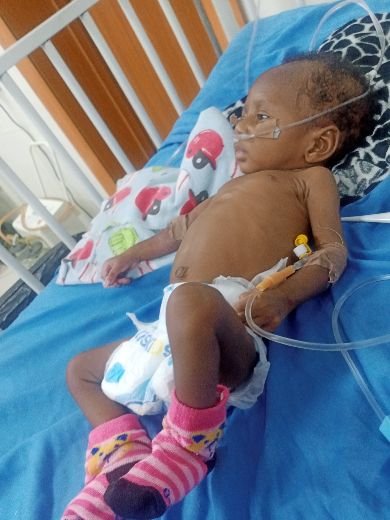  To raise money for Mirabel treatment in India 