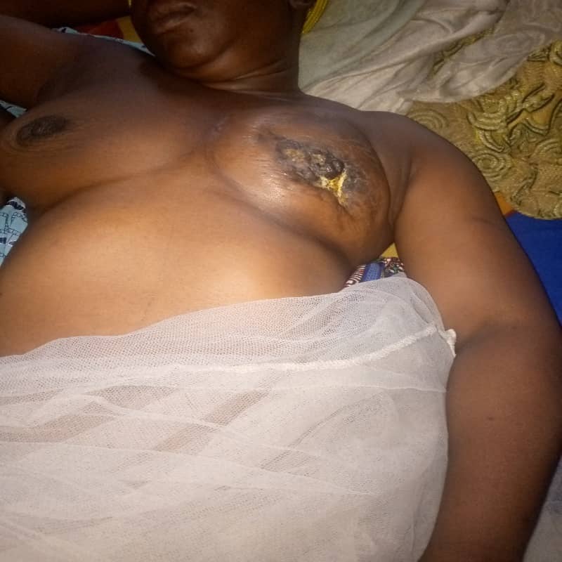 BREAST CANCER TREATMENT FUNDRAISING