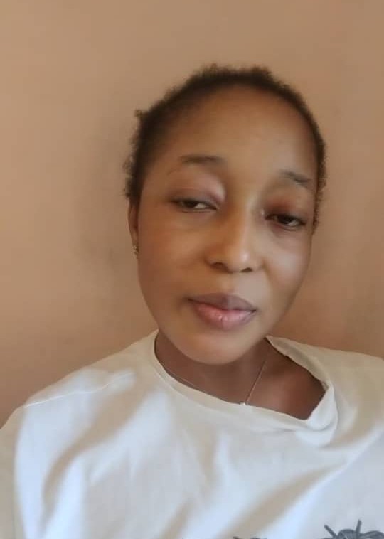 Total hip replacement surgery for tumininu