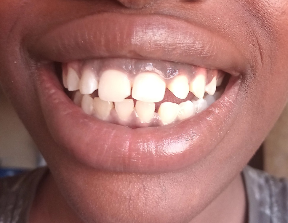 Help a Student Nurse Overcome Insecurity 