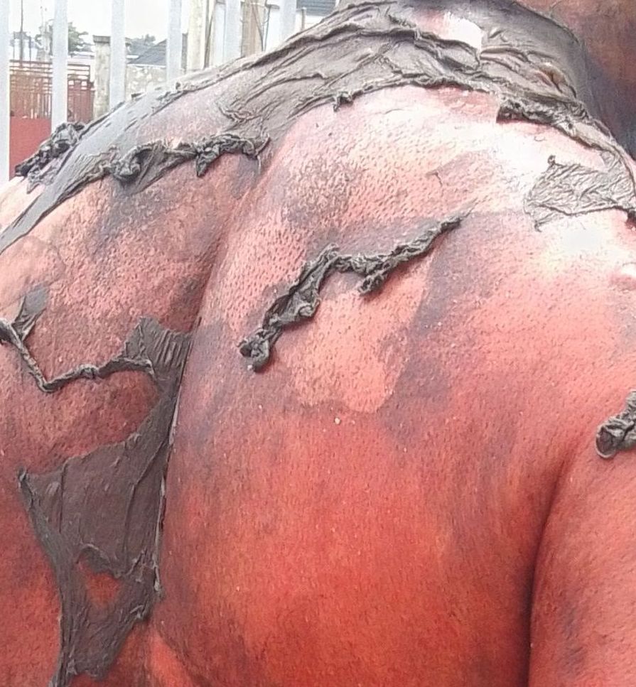 URGENT MEDICAL ATTENTION