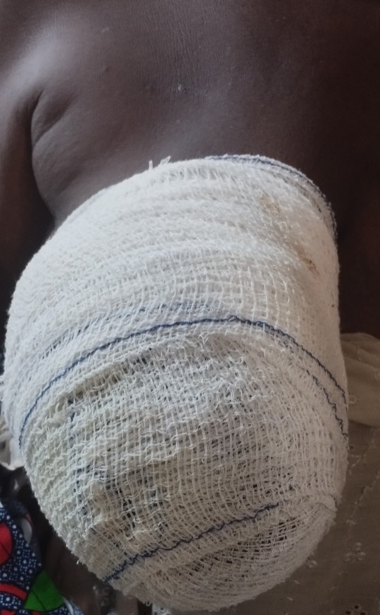 Help my mom manage her advanced cancer Symptoms 