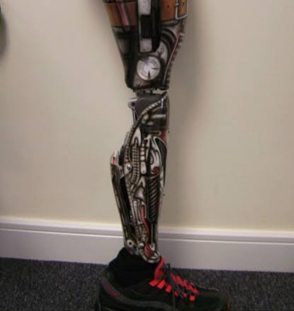 A Prosthetic Leg for Jane