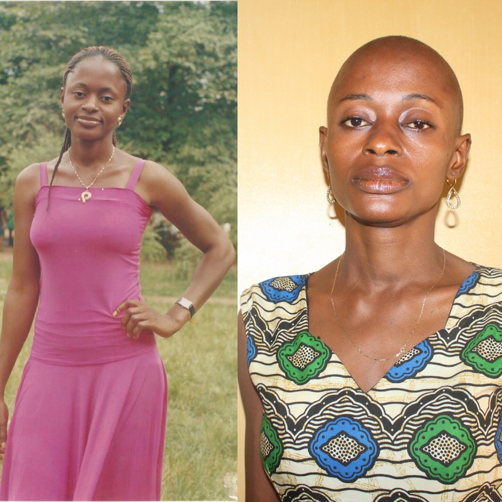 Help Ifunanya Choke Cancer #SaveIfunanya