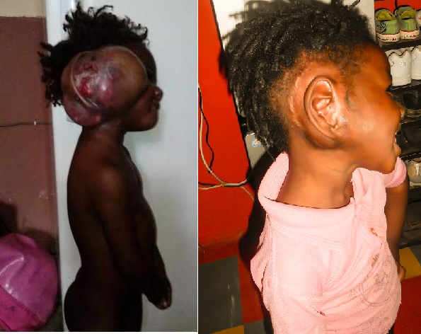 The Picture before and now