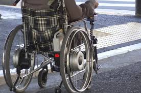 Hip surgery for indigent sickle cell patients