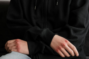 homeless mental health services