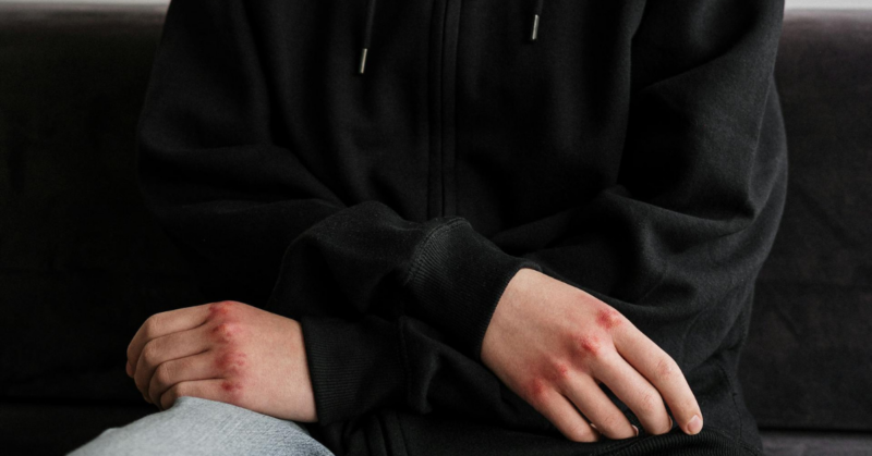 homeless mental health services