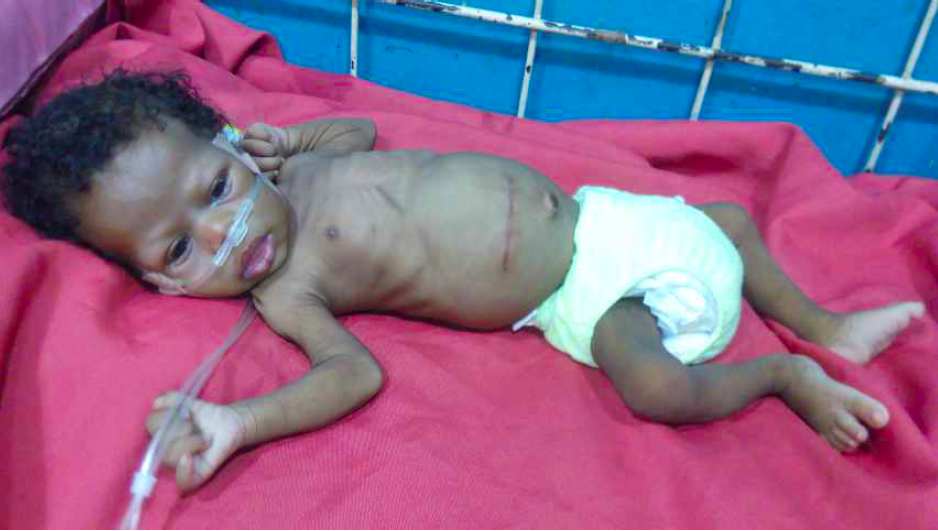 Save 4 months Adegoriola from heart disease